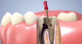 antalya esthetic dentistry