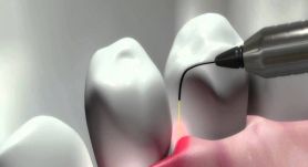 antalya esthetic dentistry